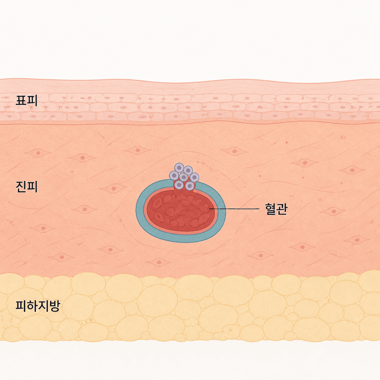 피부 속 작은 혈관과 출혈이 멎는 자리