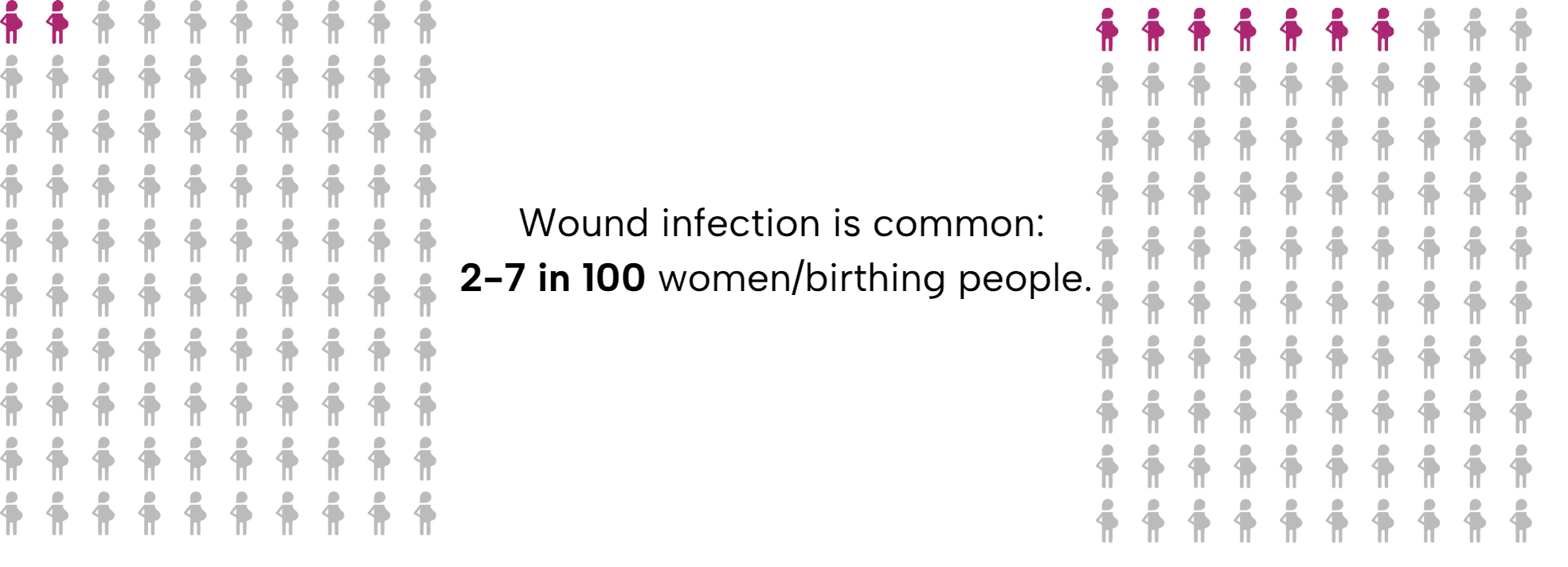 Comparative array diagrams showing that wound infection is common, around 2-7 in women or birthing people