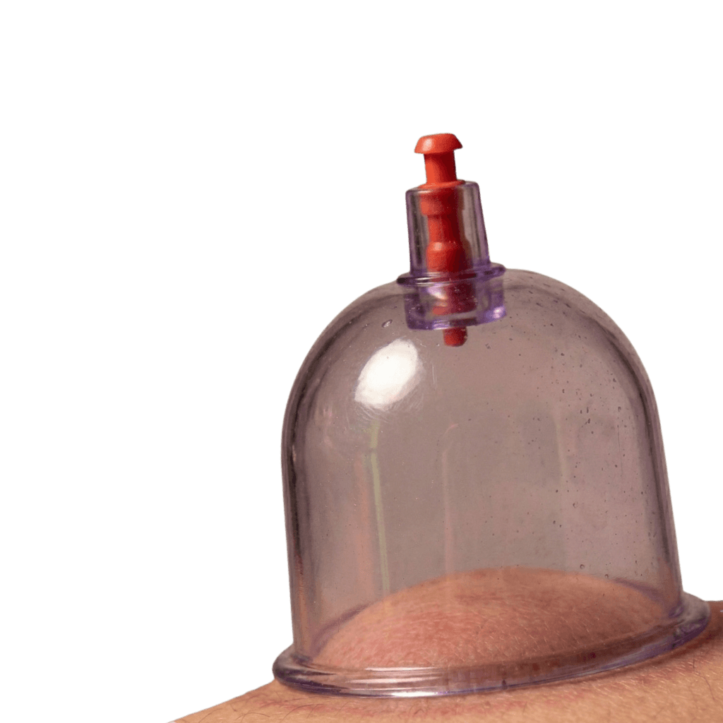 Acupuncture cup on a paitent's back