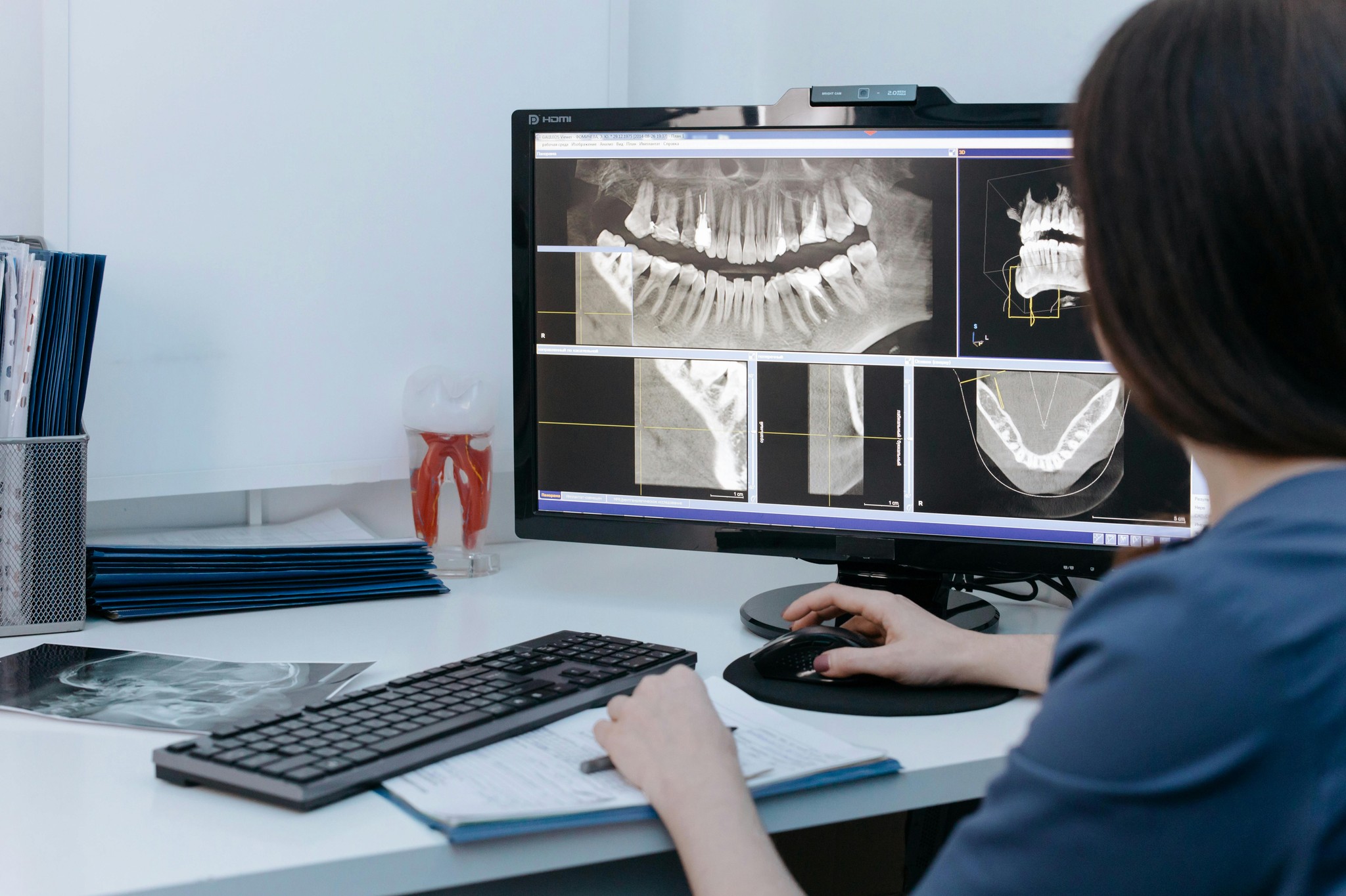 Image of a person at a computer looking at radiographs of teeth