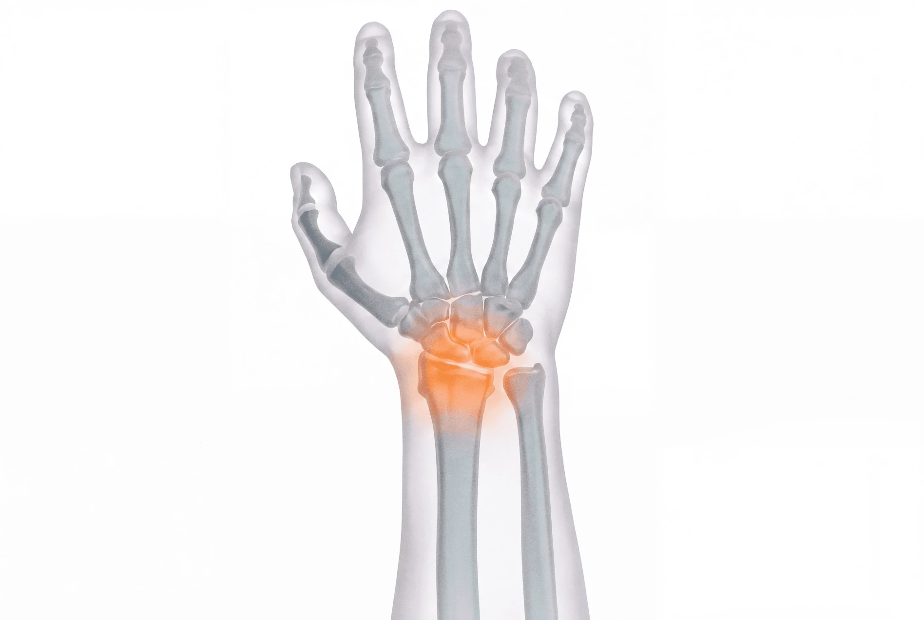 Child Torus Fracture