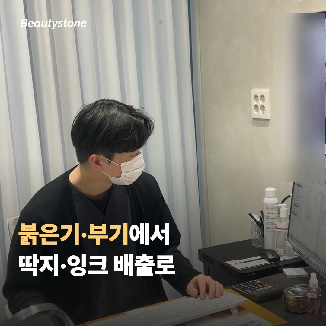 시술 직후부터 회복까지의 순서