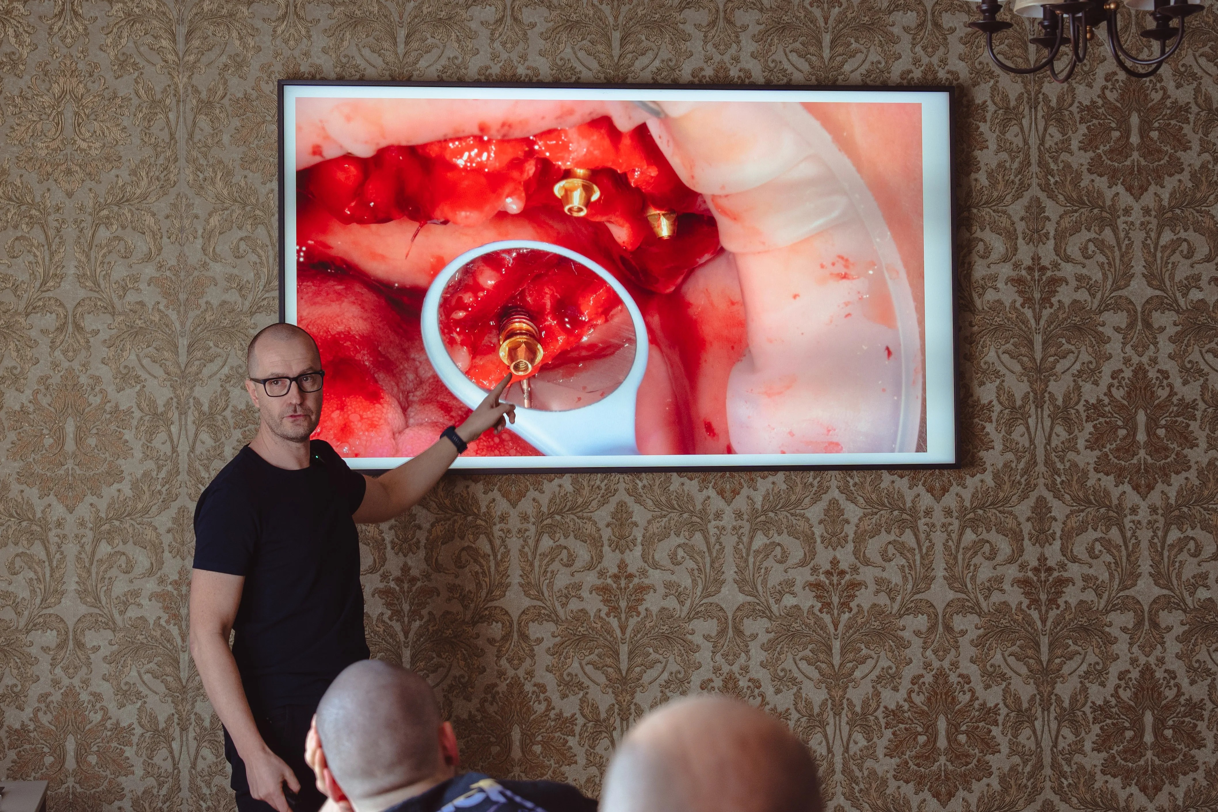 Fogászati Képzések - Teljes száj rehabilitáció – Live op - PraxEvents