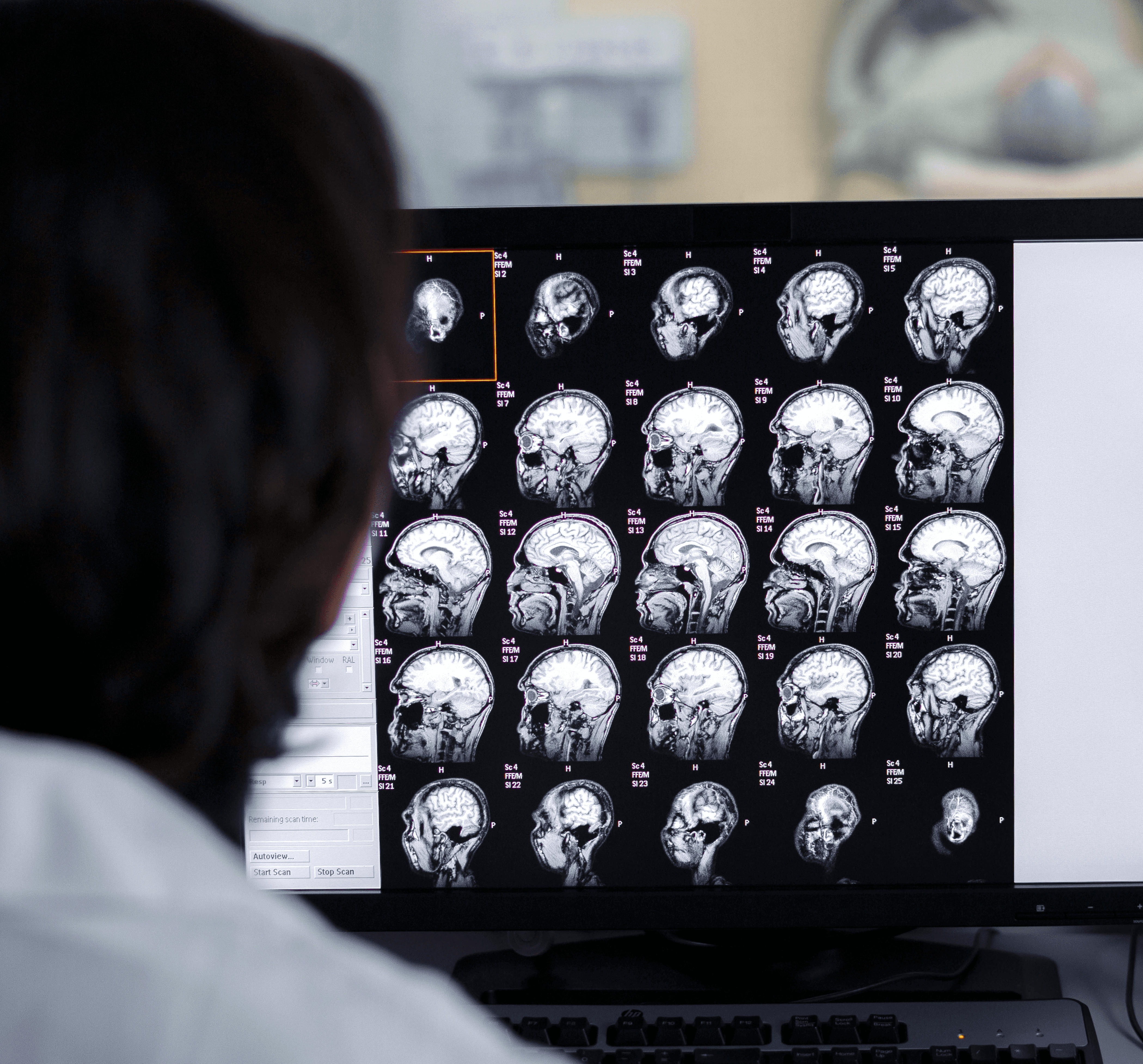 Doctor standing over patient about to go into an MRI scan