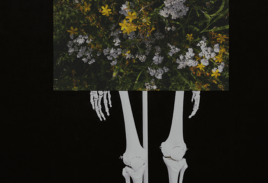 The image shows a white human skeleton against a black background. The skeleton is positioned centrally and viewed from a slightly elevated angle. Above the skeleton is a rectangular image of yellow and white flowers with green leaves, set against a dark green background. The skeleton’s arms are bent at the elbows, and its hands are open. The image is primarily in grayscale, with subtle variations in tone across the skeleton and the flower image.
