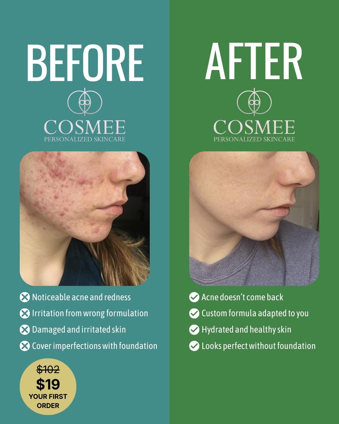 Creativo publicitario de Meta Ads para COSMEE mostrando un antes y después real de tratamiento para acné, con mejoras visibles en enrojecimiento, textura de piel y resultados personalizados