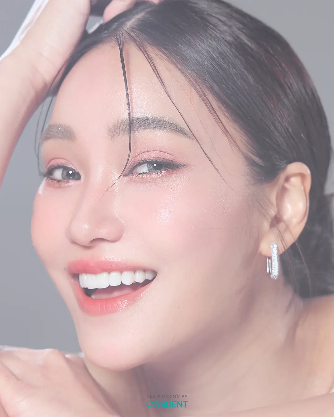 คุณชมพู่ เคสทำวีเนียร์ หมอวรรณ cosdent smile design