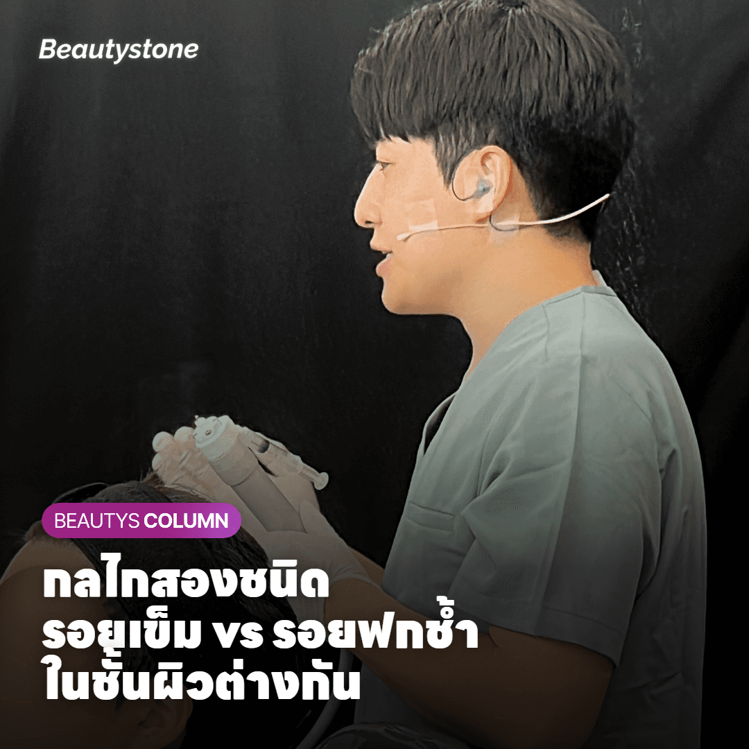 กลไกการเกิดรอยเข็มและรอยฟกช้ำในชั้นผิวต่างกันอย่างไร