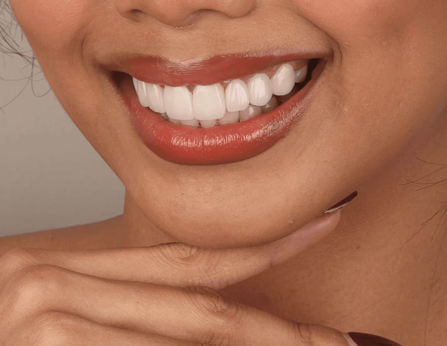 Confident patient smiling with perfectly fitted prosthodontics and high-quality removable dentures by Ora Dental.