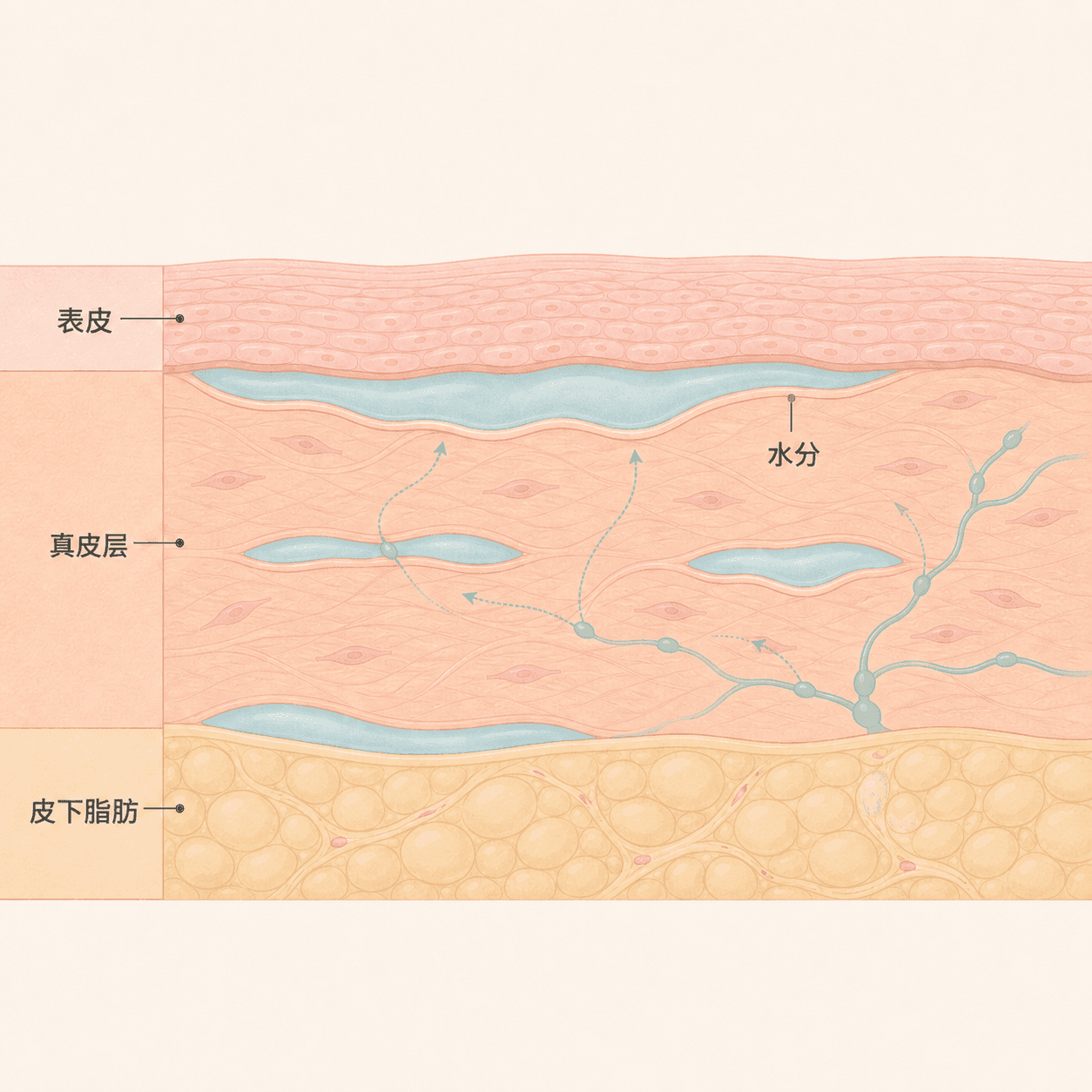 脸部组织间积聚水分形成水肿的示意图