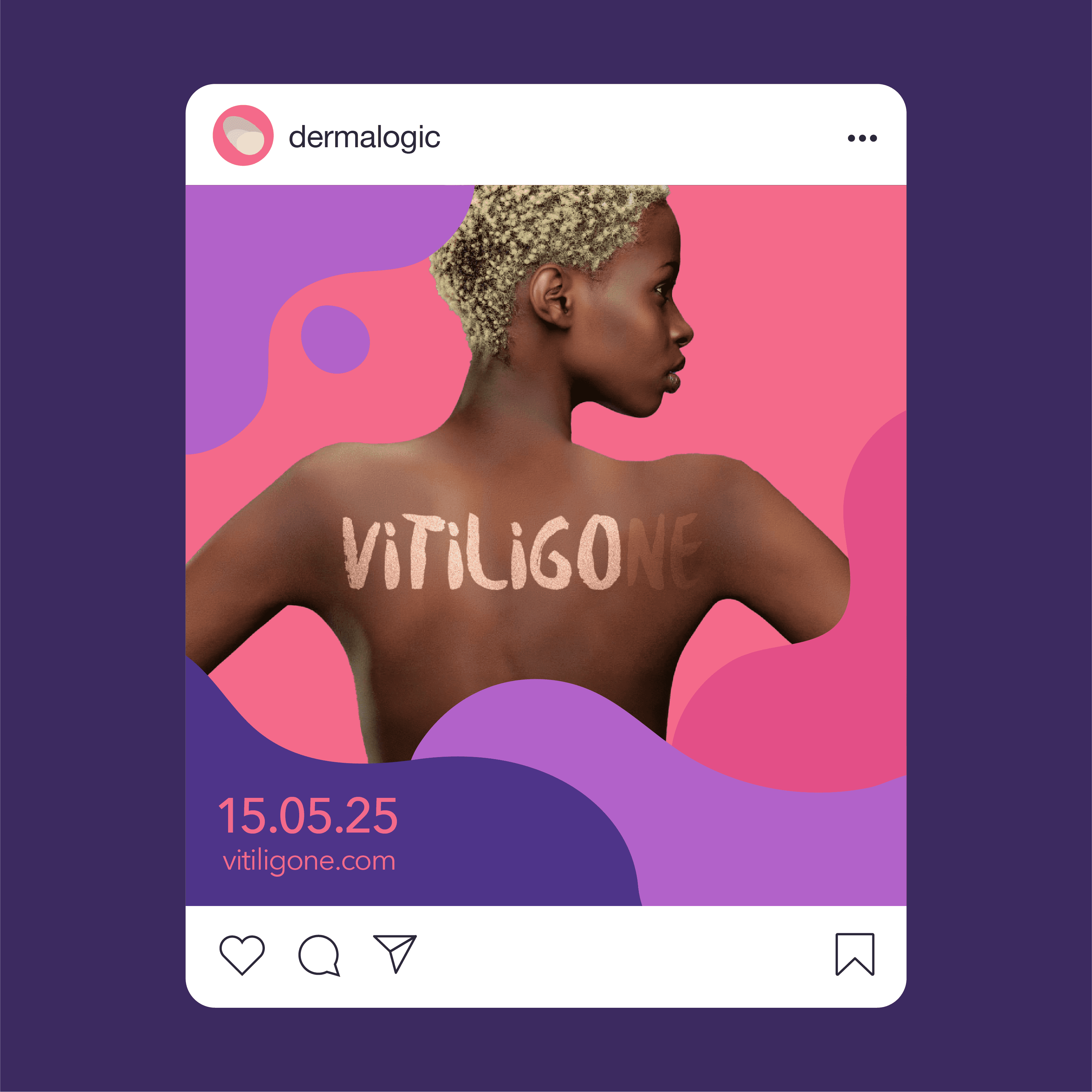 Dermato Logic Vitiligone Brand Identity Social Media Post