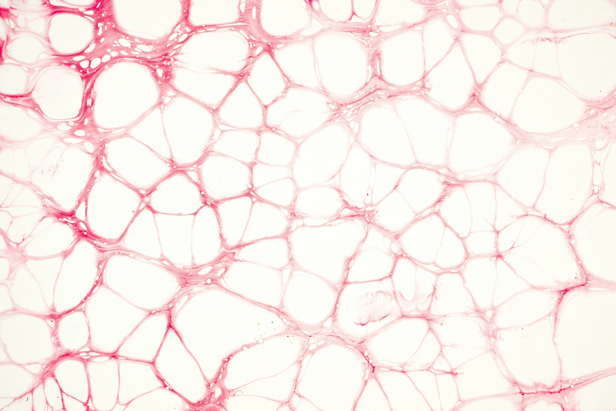 The Use of PRF for Hard and Soft Tissue Grafting | Bloor-Yorkville Periodontics