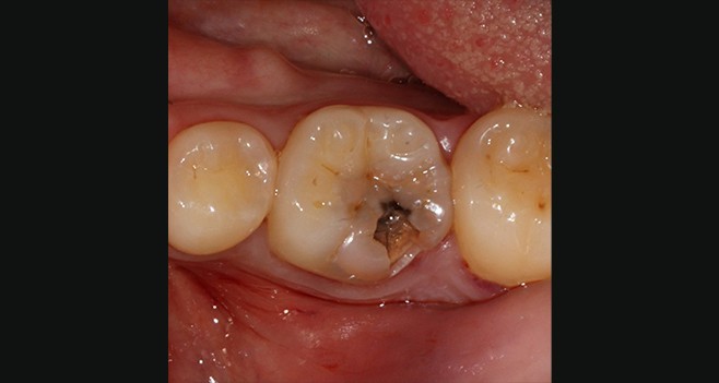 36 초진 사진