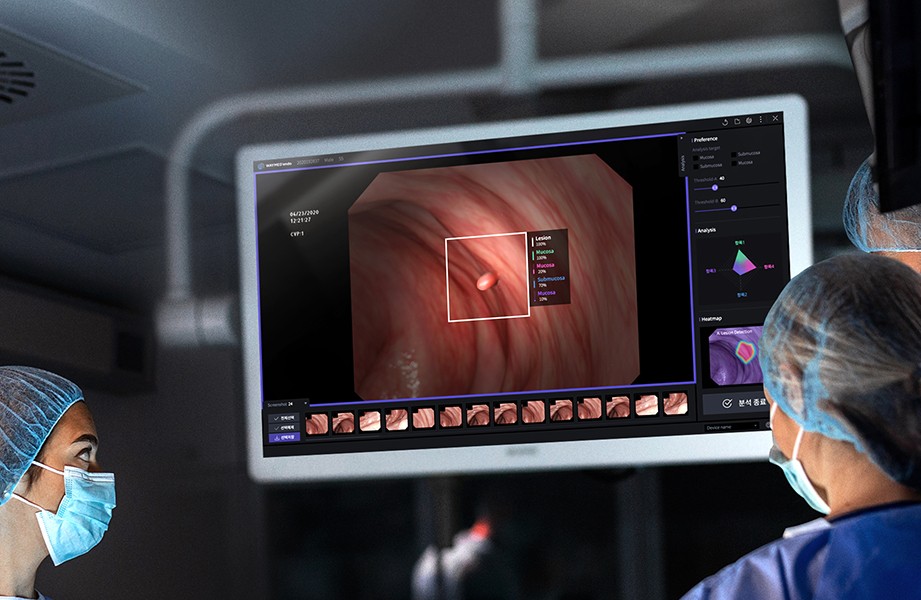 내시경 영상을 분석해 병변을 탐지하는 인공지능 의료 소프트웨어 화면