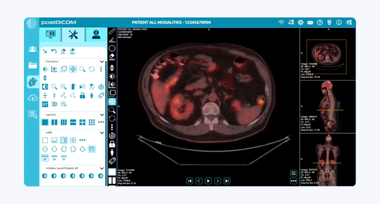 PostDICOM: Comprehensive Cloud PACS & DICOM Viewer