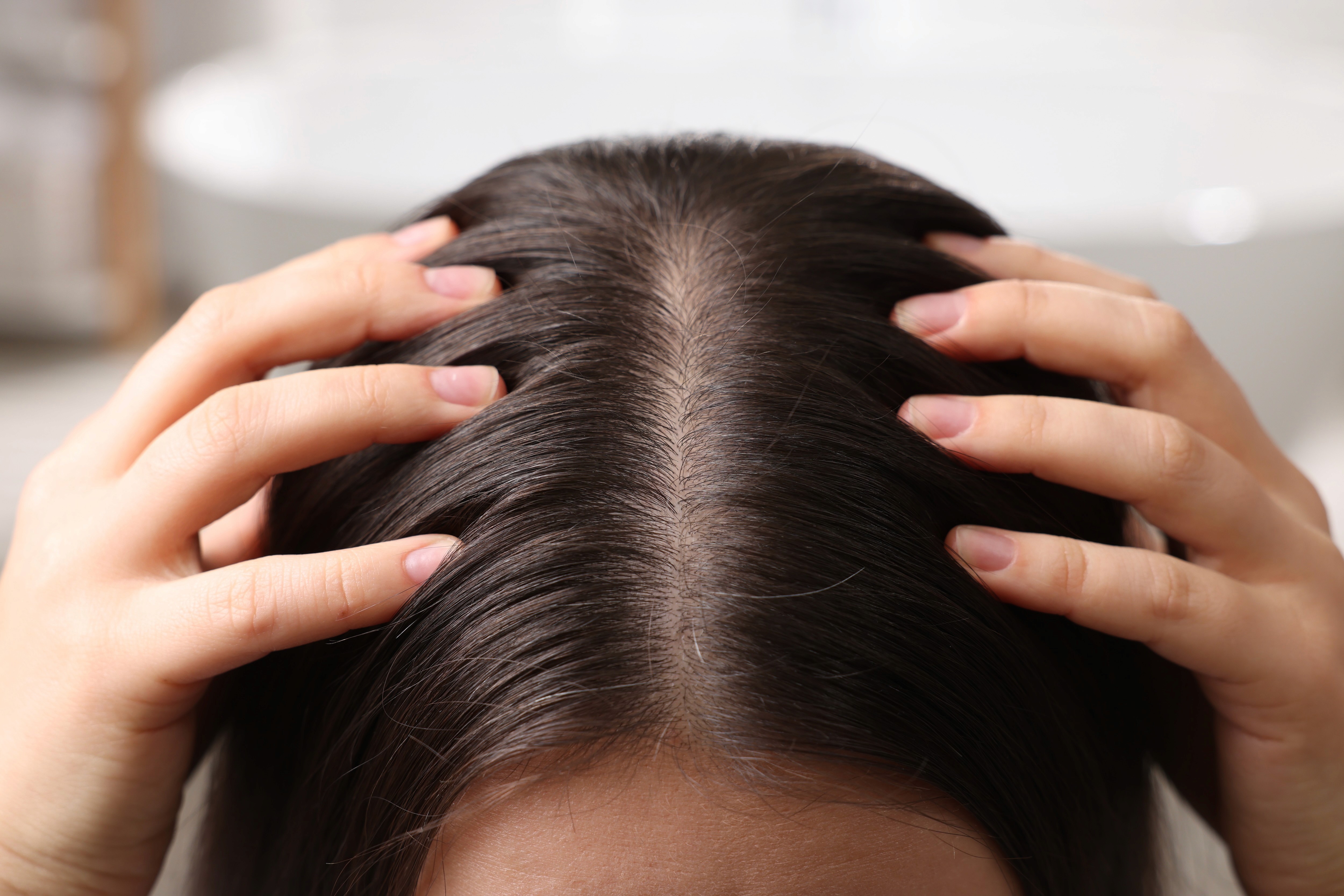 healthy scalp, after the treatment to solve the hair loss issue