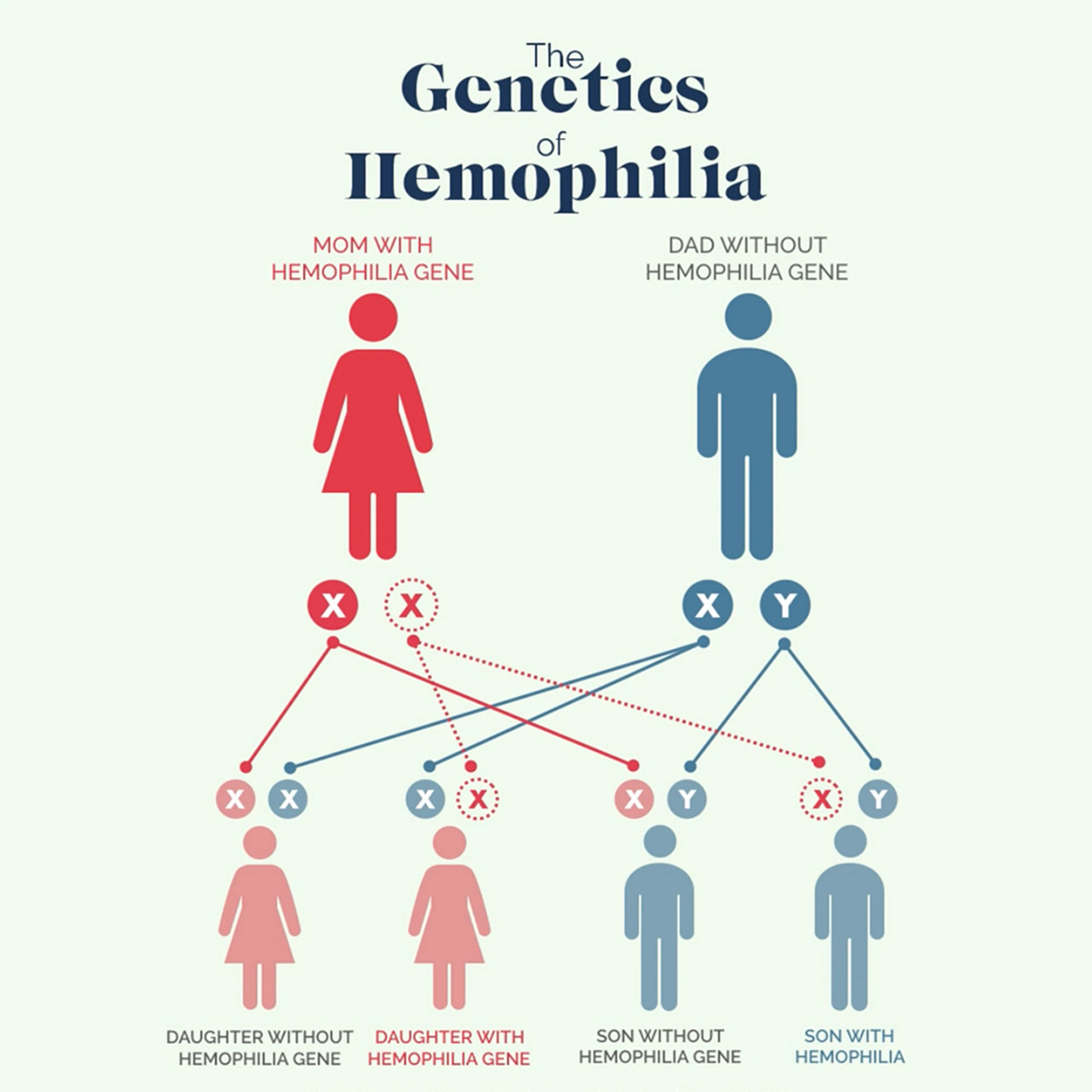 A diagram explaning the genetics of hemophilia