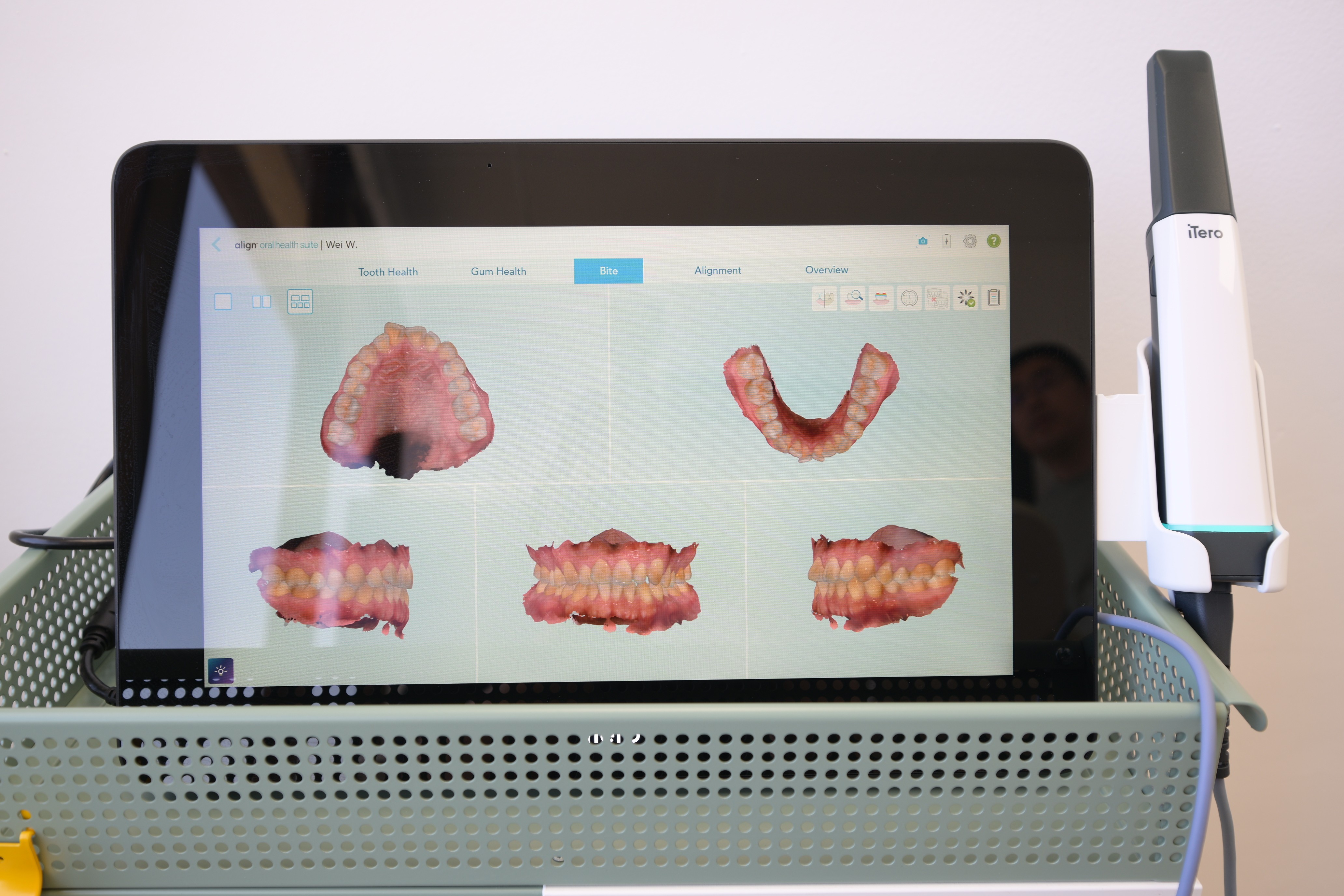 AiCare Orthodontics in Fountain Valley and Irvine