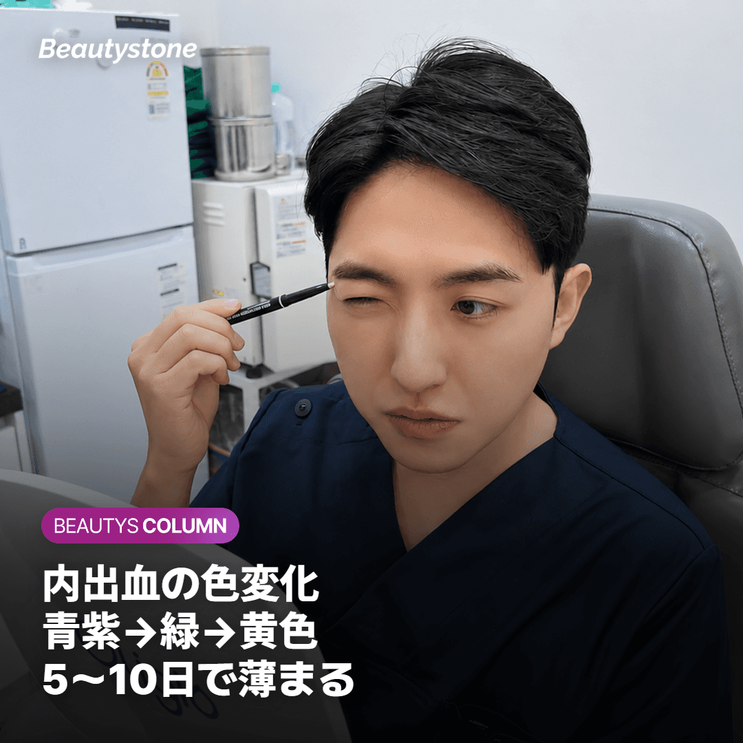 経過の目安——何日で薄くなるか