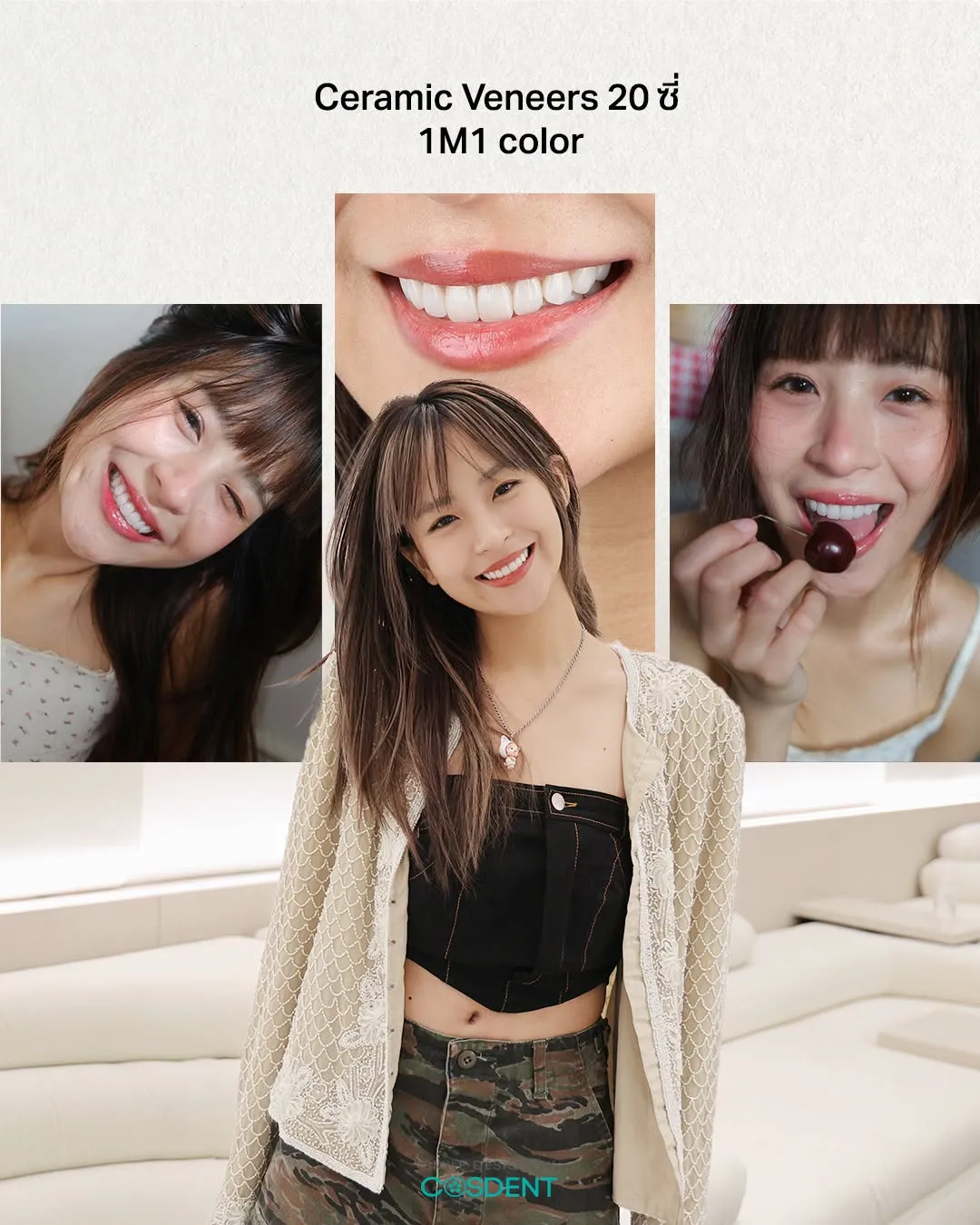 Ceramic veneers on 20 teeth in shade 1M1 — smile design case at COSDENT Bangkok