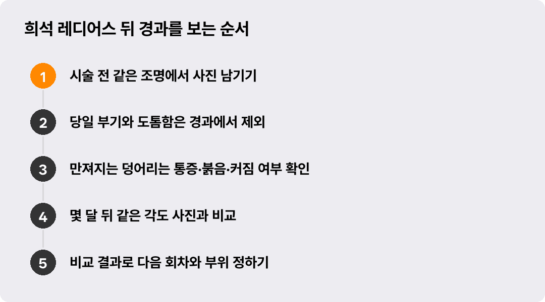 희석 레디어스 뒤 경과를 보는 순서