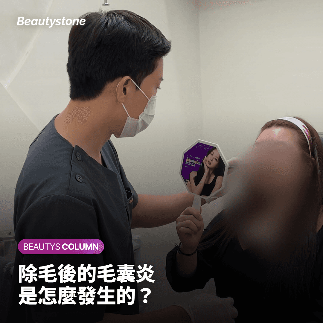 鬍鬚除毛後毛囊炎風險可能增高的情況