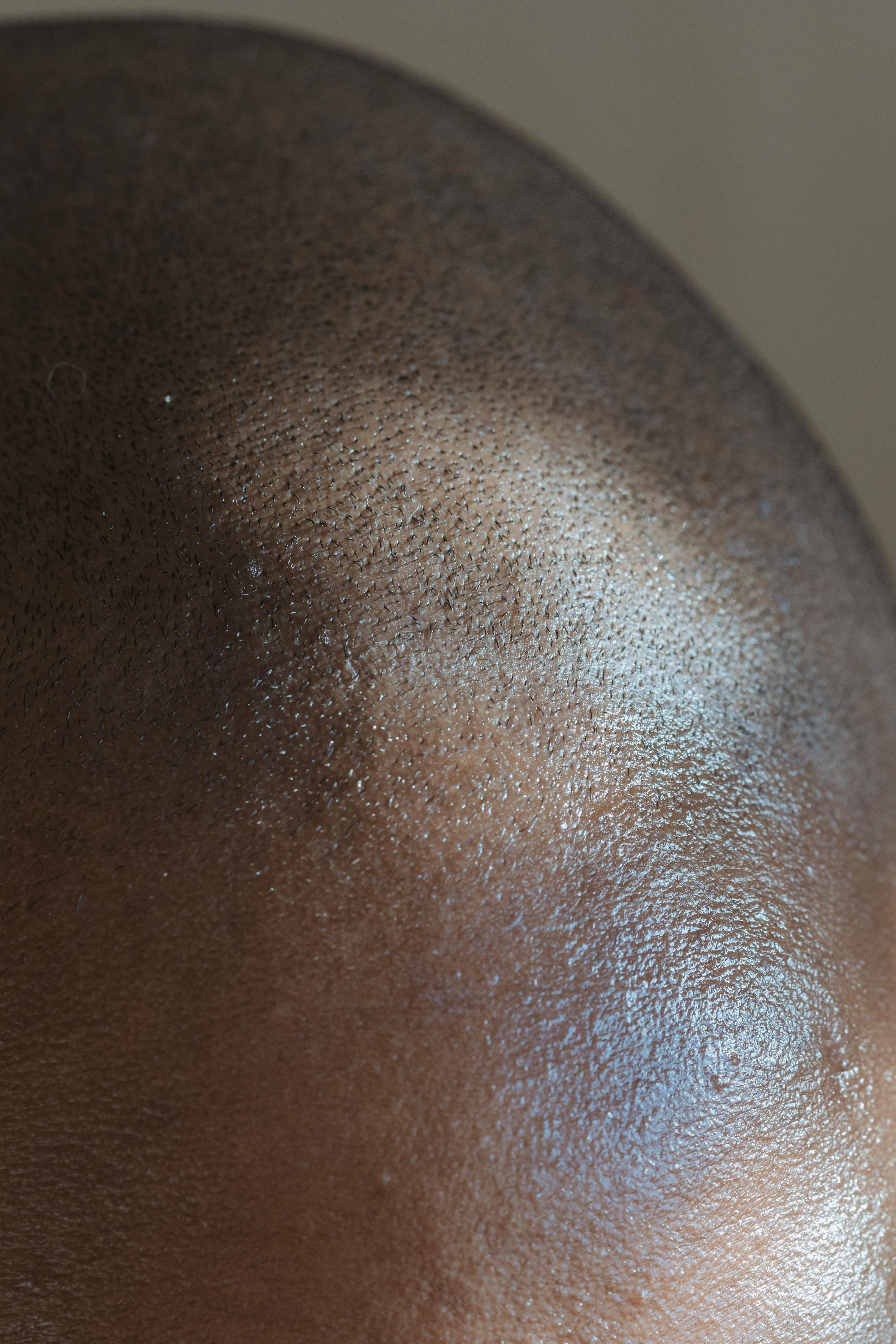 detailed-close-up-image-showing-texture-and-reflection-on-a-bald-head. - angela-roma (pexels)