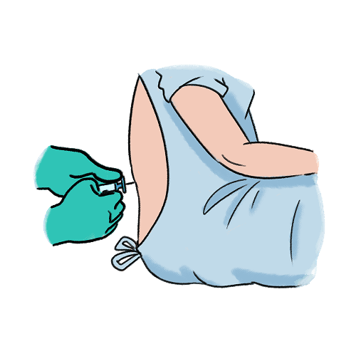 An illustration of gloved hands inserting a needle into the back of a patient. The patient is a wearing a hospital gown with the back open.