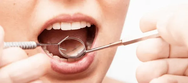 Intraoral Cameras
