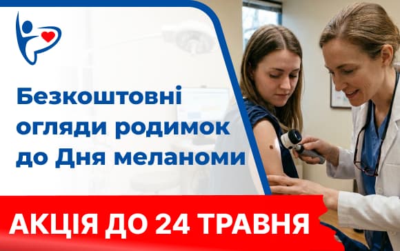 Банер "Безкоштовний огляд родимок"