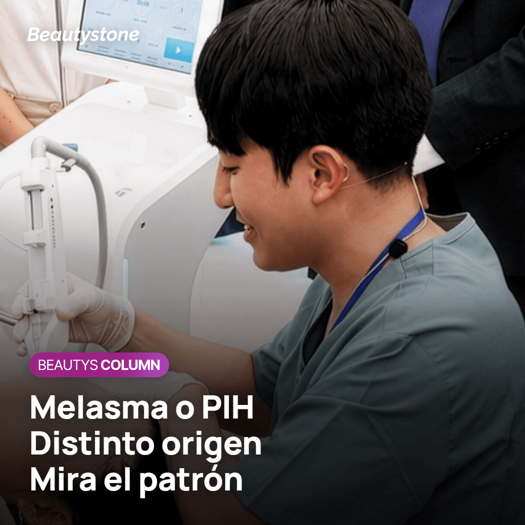 El melasma y el PIH no salen del mismo sitio