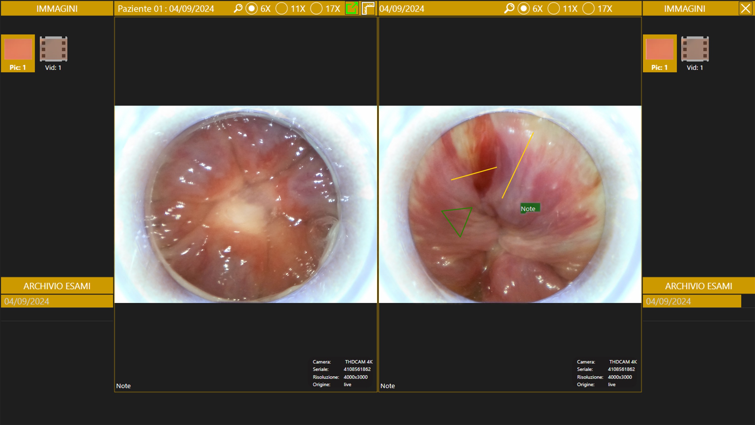 Foto del Software proprietario THD