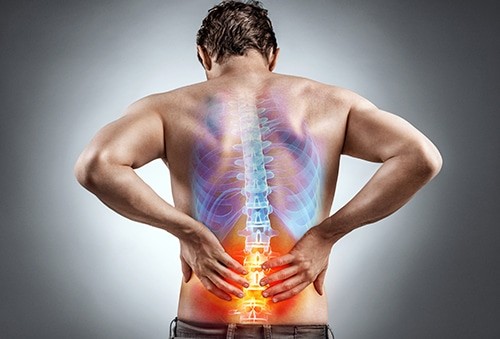 Picture showing sciatica pain radiating down the lower back and leg, highlighting how massage therapy and sports massage can provide effective relief for sciatica pain.