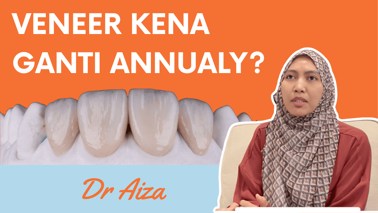 Veneer Kena Ganti Annualy?