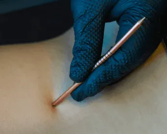 fizjoterapia i rehabilitacja