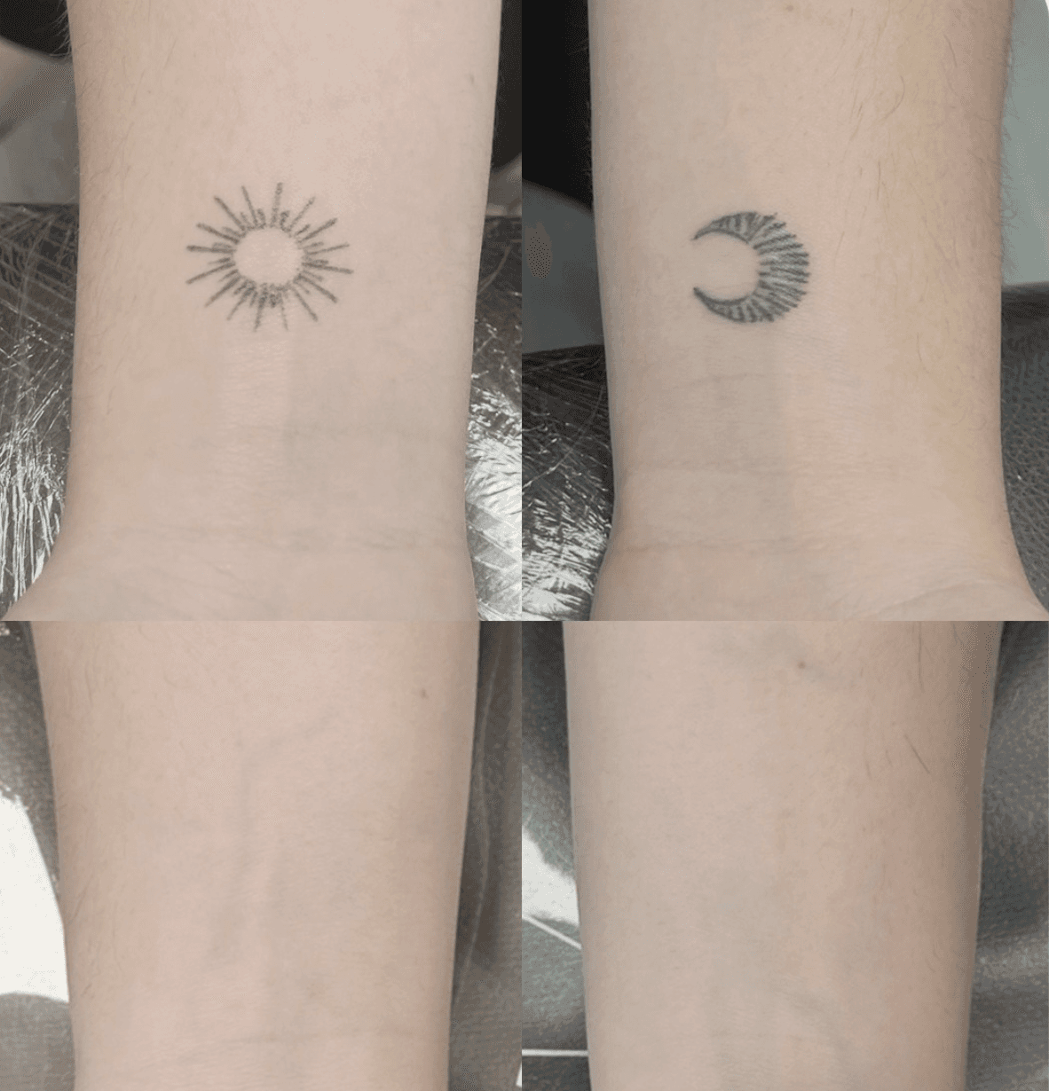 Haarausfall Männer Schweiz