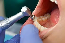 dental cleaning in smyrna