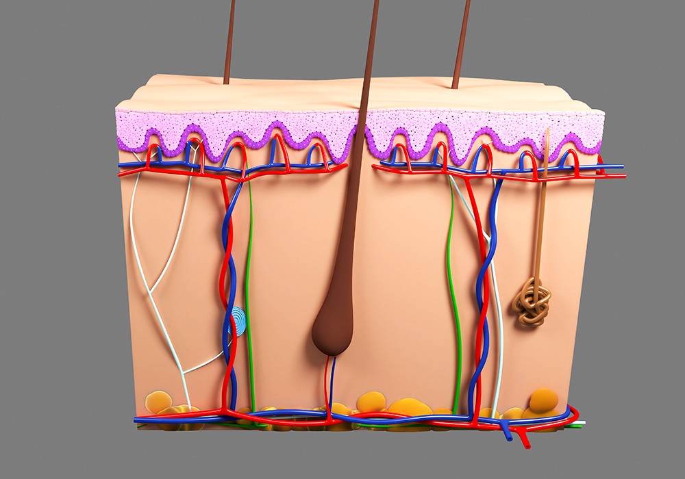 sebaceous glands produce excess sebum, leaving the skin shiny and pores enlarged