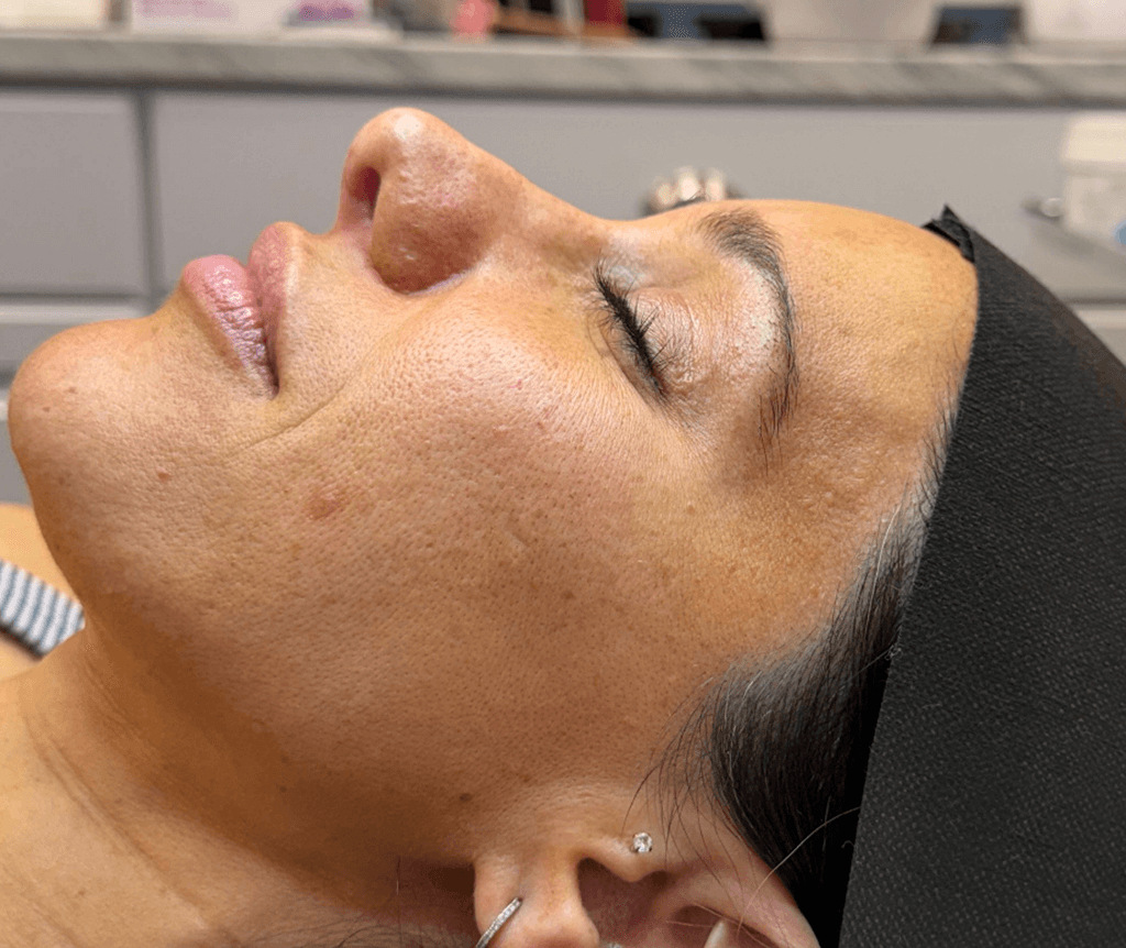 Glass Skin Facial Oyster Bay before