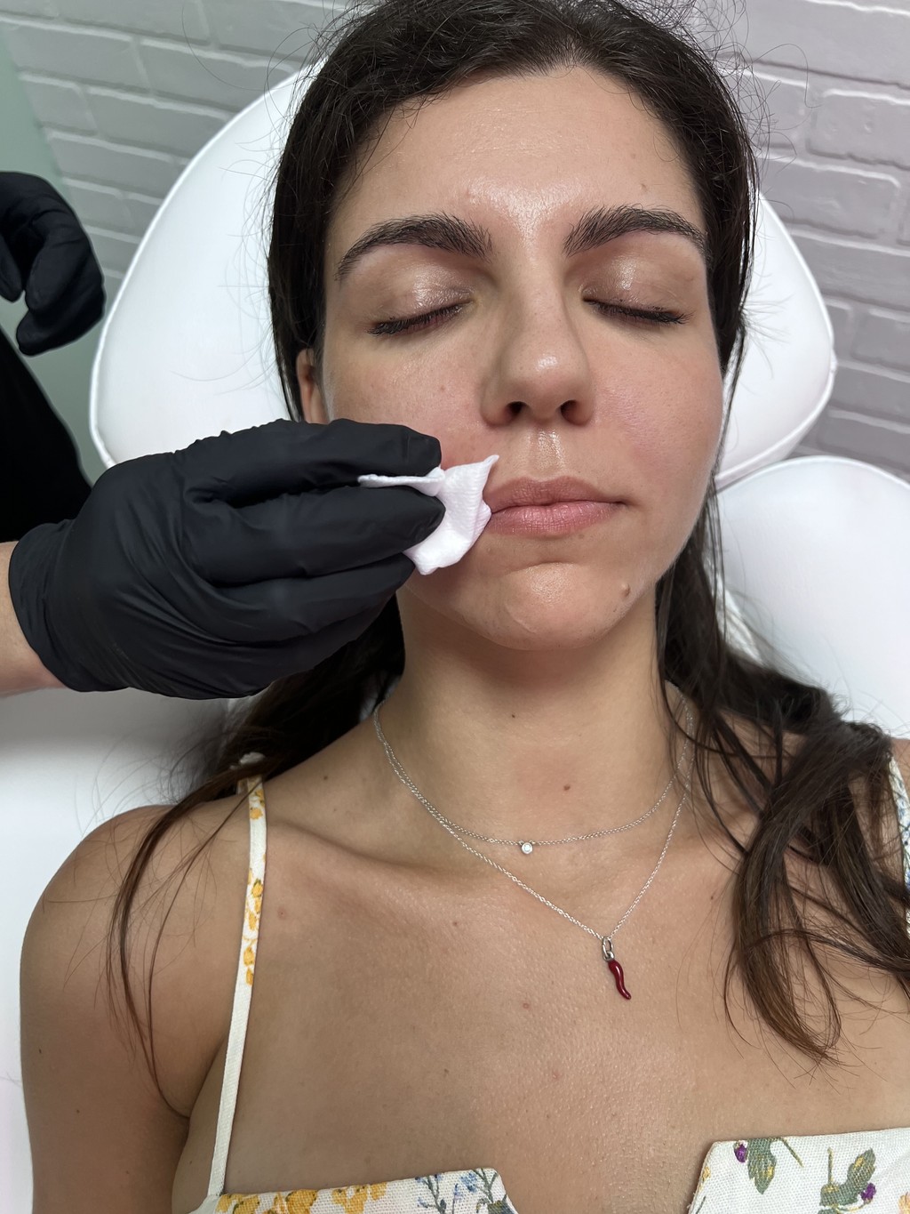 Patient comfortably lying down and relaxing while receiving a Botox injection at a medical spa in Delray Beach, Florida.