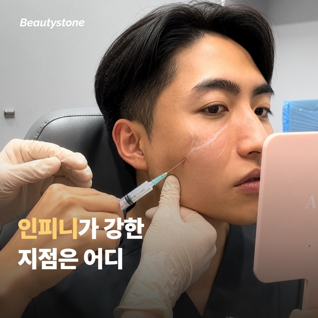 인피니 RF가 강한 지점