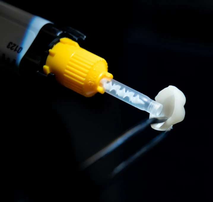 Kobieta z uśmiechem prezentująca efekty bondingu na swoich zębach.