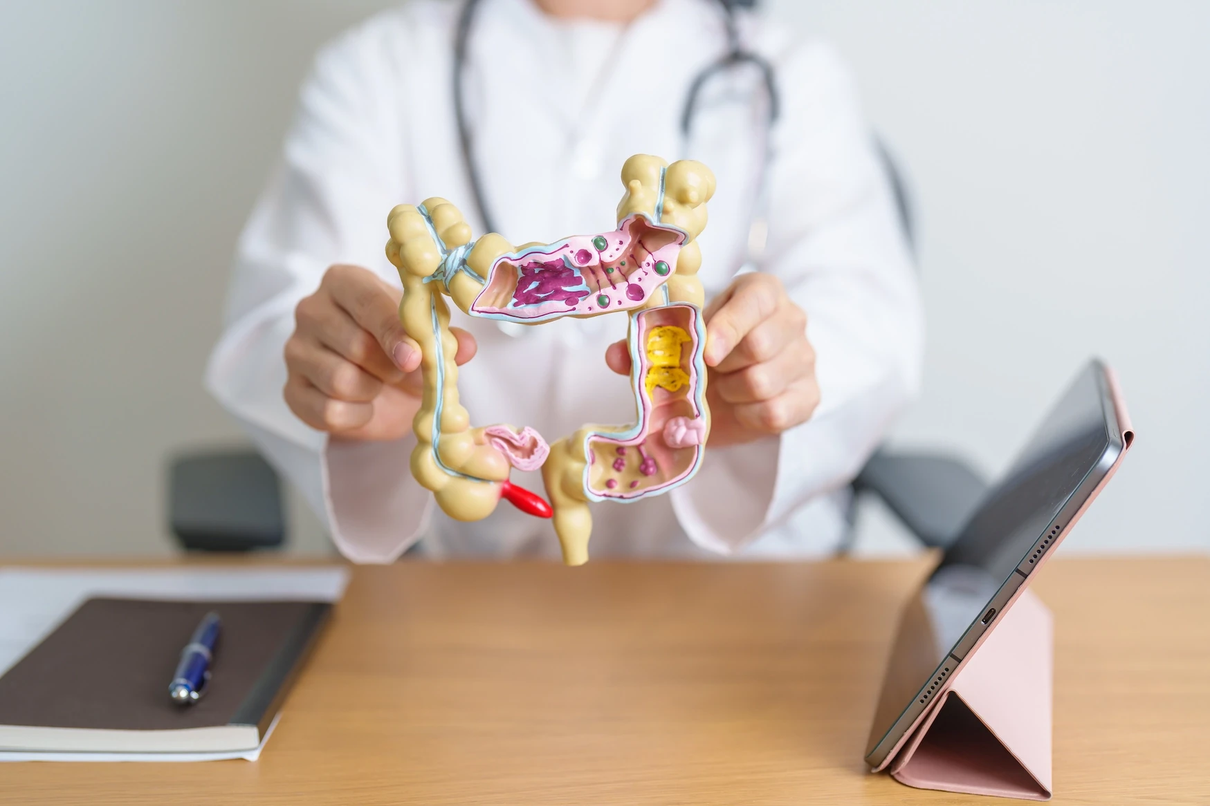 Doenças Inflamatórias Intestinais