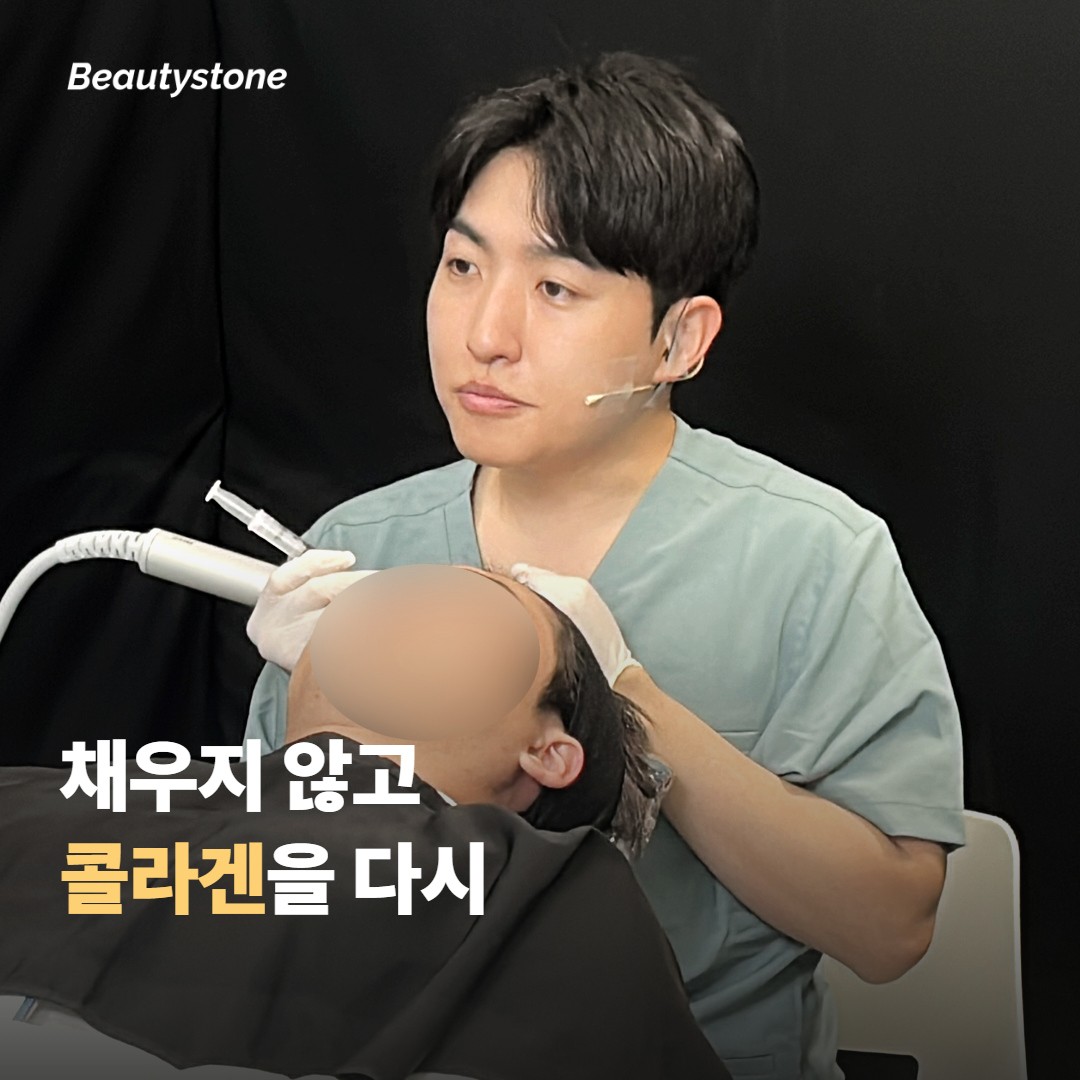 스컬트라는 채우는 게 아니라 콜라겐을 다시 만들게 해요