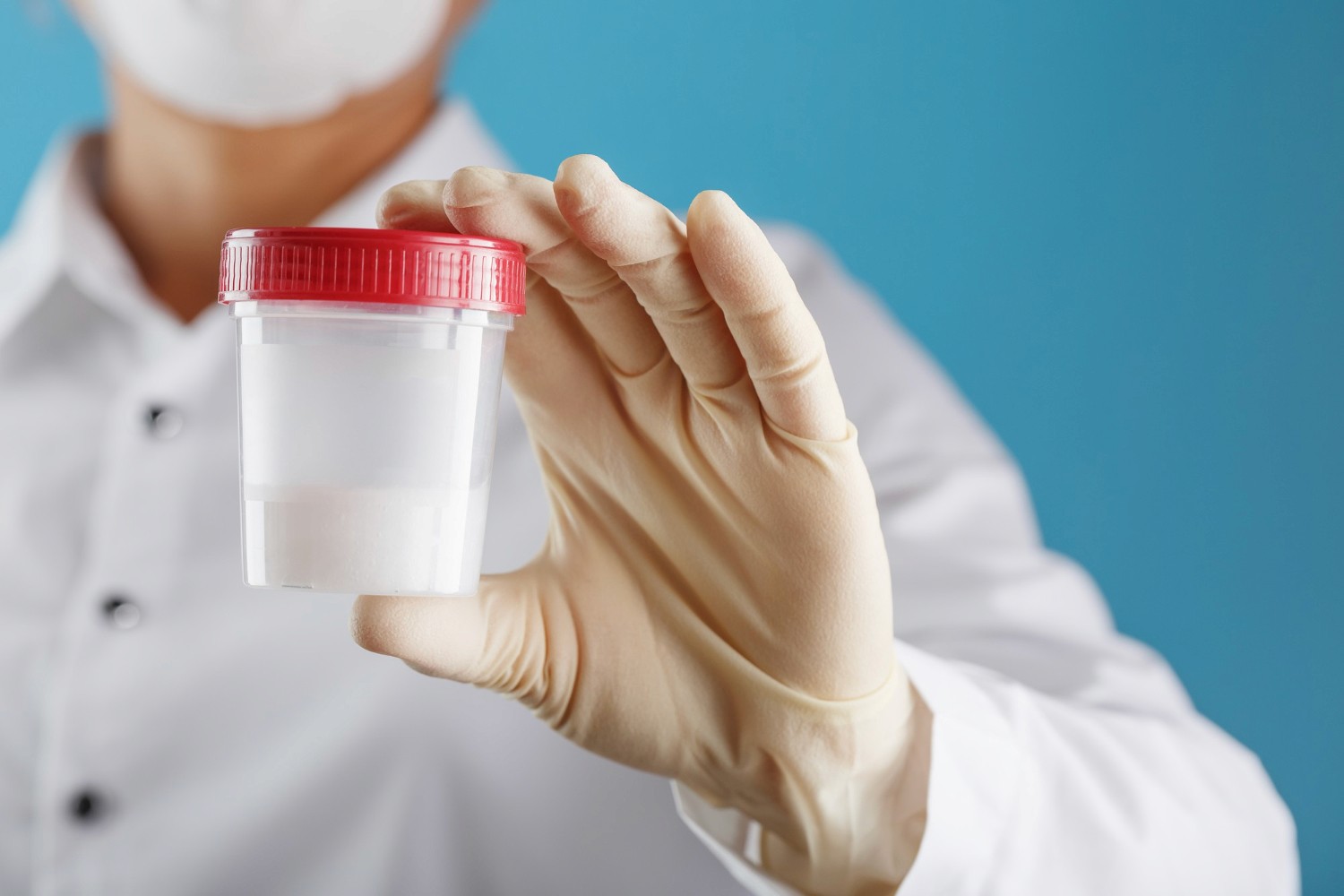Semen Analysis
