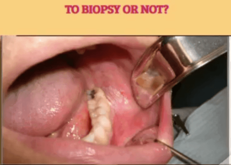 Biopsy image
