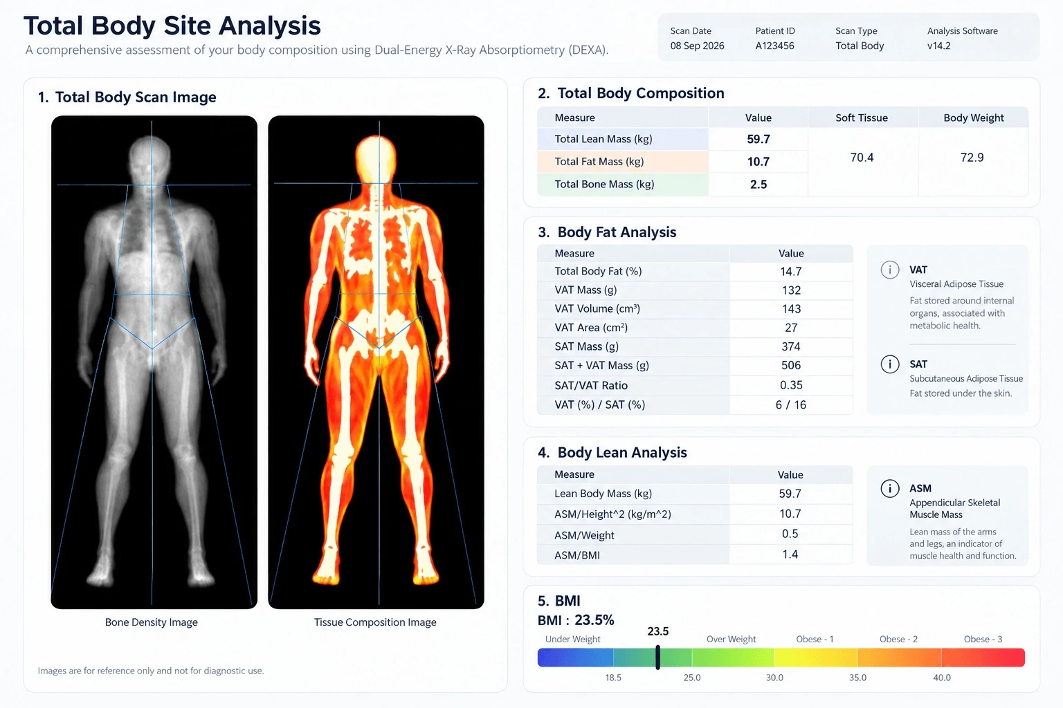 A sample dexa report