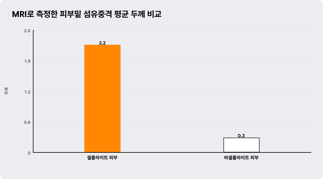 MRI로 측정한 피부밑 섬유중격 평균 두께 비교