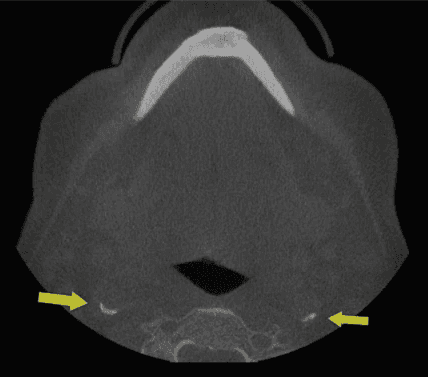 Dark mode compatible CBCT illustration