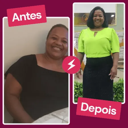 Antes e Depois 2